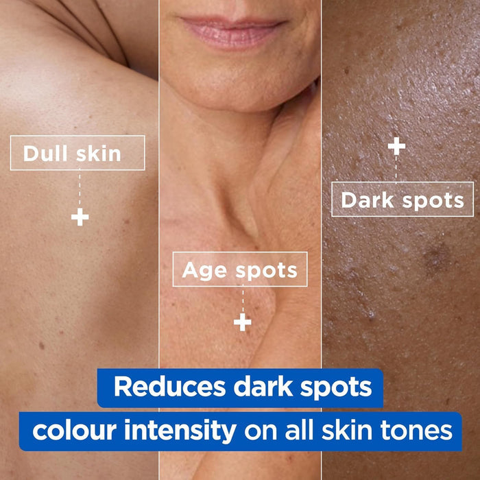 Mixa Niacinamide Bright Moisturising Anti-Dark Spot Cream 400ml